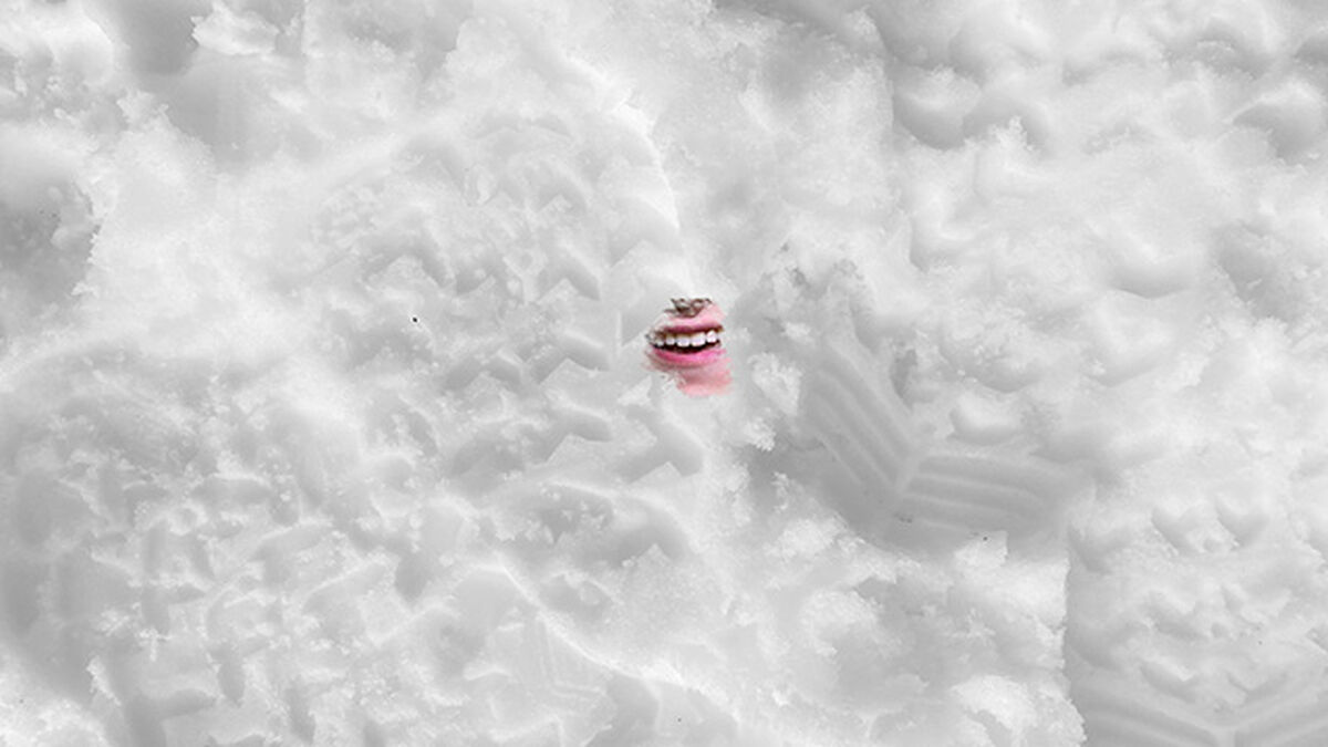 My Tooth Front Teeth image number null